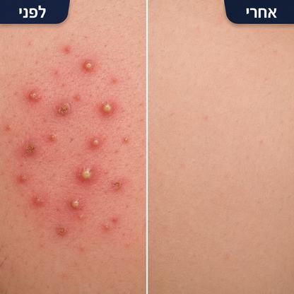 LyonRise Intimate Shield
